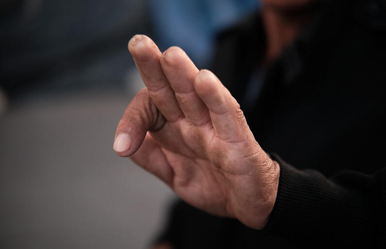 Adrian, a 65-year-old farmer from Zacatecas, shows the fingers that his kidnappers mutilated. Ciudad Juarez, Mexico. 2019.
